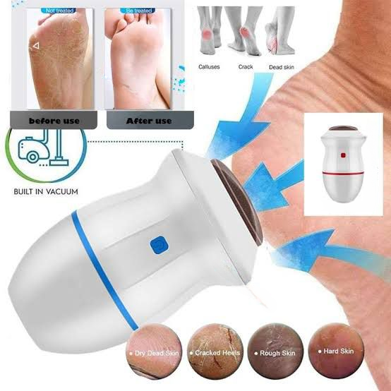 Rechargeable Electric Foot Callus Remover with Replacement Head – Portable Pedicure Tool for Cracked Heels