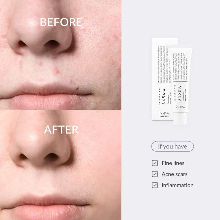 Dr.Althea 345 Relief Cream 100% Orignal